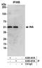 Internexin Neuronal Intermediate Filament Protein Alpha antibody, A305-431A, Bethyl Labs, Immunoprecipitation image 