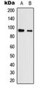 Latent Transforming Growth Factor Beta Binding Protein 1 antibody, orb234893, Biorbyt, Western Blot image 