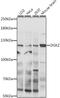 Diacylglycerol Kinase Zeta antibody, A06678-1, Boster Biological Technology, Western Blot image 
