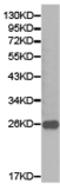 CD79b Molecule antibody, TA323605, Origene, Western Blot image 