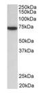 Zeta Chain Of T Cell Receptor Associated Protein Kinase 70 antibody, orb12371, Biorbyt, Western Blot image 