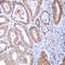 Mitochondrial Ribosomal Protein L24 antibody, LS-C354200, Lifespan Biosciences, Immunohistochemistry paraffin image 