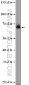 Keratin 1 antibody, 16848-1-AP, Proteintech Group, Western Blot image 
