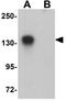 Probable phospholipid-transporting ATPase IF antibody, GTX85003, GeneTex, Western Blot image 