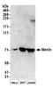 Menin 1 antibody, A300-115A, Bethyl Labs, Western Blot image 