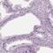 Chromosome 2 Open Reading Frame 81 antibody, PA5-65901, Invitrogen Antibodies, Immunohistochemistry paraffin image 