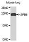 Heat shock protein beta-6 antibody, A9887, ABclonal Technology, Western Blot image 