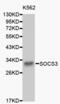 Suppressor of cytokine signaling 3 antibody, abx000829, Abbexa, Western Blot image 