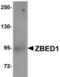 Zinc finger BED domain-containing protein 1 antibody, TA306754, Origene, Western Blot image 