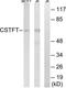 Cleavage Stimulation Factor Subunit 2 Tau Variant antibody, TA315235, Origene, Western Blot image 