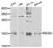 Regenerating Family Member 3 Alpha antibody, LS-C331896, Lifespan Biosciences, Western Blot image 