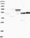 Mitochondrial tRNA-specific 2-thiouridylase 1 antibody, NBP1-82197, Novus Biologicals, Western Blot image 