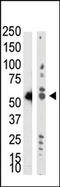 TRNA Aspartic Acid Methyltransferase 1 antibody, AP11029PU-N, Origene, Western Blot image 