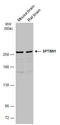 Spectrin Beta, Non-Erythrocytic 1 antibody, GTX130935, GeneTex, Western Blot image 