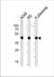 Actin, alpha skeletal muscle antibody, TA324566, Origene, Western Blot image 