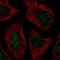CCR4-NOT transcription complex subunit 7 antibody, NBP2-57301, Novus Biologicals, Immunofluorescence image 