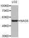 N-Acetylglutamate Synthase antibody, MBS129258, MyBioSource, Western Blot image 