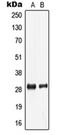Low Density Lipoprotein Receptor Class A Domain Containing 2 antibody, orb215425, Biorbyt, Western Blot image 