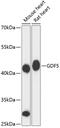 Growth Differentiation Factor 5 antibody, 14-832, ProSci, Western Blot image 