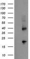 Tubulin Folding Cofactor C antibody, TA504709S, Origene, Western Blot image 
