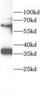Protein Tyrosine Phosphatase Non-Receptor Type 6 antibody, FNab10726, FineTest, Western Blot image 