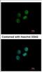Zwilch Kinetochore Protein antibody, NBP2-21057, Novus Biologicals, Immunocytochemistry image 