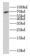 Family With Sequence Similarity 117 Member B antibody, FNab02957, FineTest, Western Blot image 