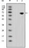 Protein Wnt-5a antibody, STJ98453, St John