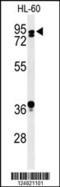 Protein PAT1 homolog 1 antibody, MBS9201631, MyBioSource, Western Blot image 