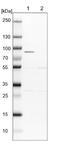 Serine/threonine-protein kinase Nek8 antibody, NBP1-82539, Novus Biologicals, Western Blot image 