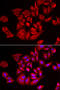 Tousled Like Kinase 2 antibody, 22-473, ProSci, Immunofluorescence image 