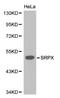 Sushi Repeat Containing Protein X-Linked antibody, LS-C192479, Lifespan Biosciences, Western Blot image 