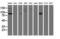 Aldehyde Dehydrogenase 1 Family Member L1 antibody, GTX84892, GeneTex, Western Blot image 