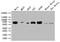 Glucosylceramidase Beta antibody, CSB-RA869334A0HU, Cusabio, Western Blot image 