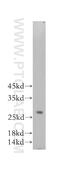RAB27A, Member RAS Oncogene Family antibody, 17817-1-AP, Proteintech Group, Western Blot image 