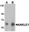 Ankyrin Repeat And LEM Domain Containing 1 antibody, TA320094, Origene, Western Blot image 