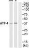 ATF4 antibody, TA326209, Origene, Western Blot image 