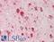 Early Endosome Antigen 1 antibody, LS-B12338, Lifespan Biosciences, Immunohistochemistry paraffin image 