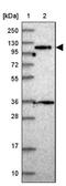 Protein Phosphatase 6 Regulatory Subunit 1 antibody, NBP2-48803, Novus Biologicals, Western Blot image 