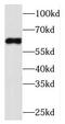 Phosphatidylinositol-4-Phosphate 5-Kinase Type 1 Beta antibody, FNab06464, FineTest, Western Blot image 