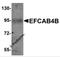 EF-hand calcium-binding domain-containing protein 4B antibody, 6045, ProSci, Western Blot image 