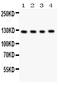 HERG antibody, PB9257, Boster Biological Technology, Western Blot image 