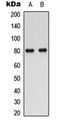 Sodium/myo-inositol cotransporter antibody, orb304590, Biorbyt, Western Blot image 