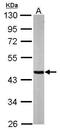 Succinyl-CoA ligase [ADP-forming] subunit beta, mitochondrial antibody, TA308975, Origene, Western Blot image 