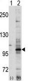 Ephrin type-A receptor 7 antibody, GTX25411, GeneTex, Western Blot image 