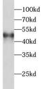 Protein Phosphatase 2 Regulatory Subunit Bbeta antibody, FNab06717, FineTest, Western Blot image 