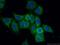 CAP-Gly domain-containing linker protein 1 antibody, 23839-1-AP, Proteintech Group, Immunofluorescence image 