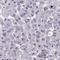 Nuclear Transcription Factor, X-Box Binding Like 1 antibody, HPA059132, Atlas Antibodies, Immunohistochemistry paraffin image 