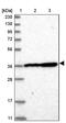 DnaJ Heat Shock Protein Family (Hsp40) Member B14 antibody, PA5-57494, Invitrogen Antibodies, Western Blot image 
