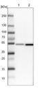 Dihydrolipoamide Branched Chain Transacylase E2 antibody, NBP1-89522, Novus Biologicals, Western Blot image 